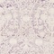 See color option for 8' x 8' New Vintage Round Rug