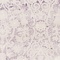 See color option for 6' x 6' New Vintage Round Rug