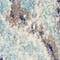 See color option for 2' 2 x 6' Heritage Runner Rug