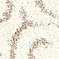 See color option for 2' x 6' 7 Floral Shag Runner Rug