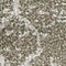 See color option for 2' x 6' Trellis Runner Rug