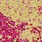 See color option for Unique Loom 2' 2 x 6' 7 Medici Runner Rug