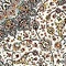 See color option for 3' 3 x 13' Dynasty Runner Rug