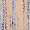 See color option for 5' x 8' Braided Chindi Oval Rug