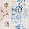 See color option for 2' 7 x 8' 2 Madrid Runner Rug