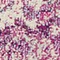 See color option for 2' 2 x 6' Madeline Runner Rug