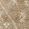 See color option for 5' x 5' Marrakesh Shag Round Rug